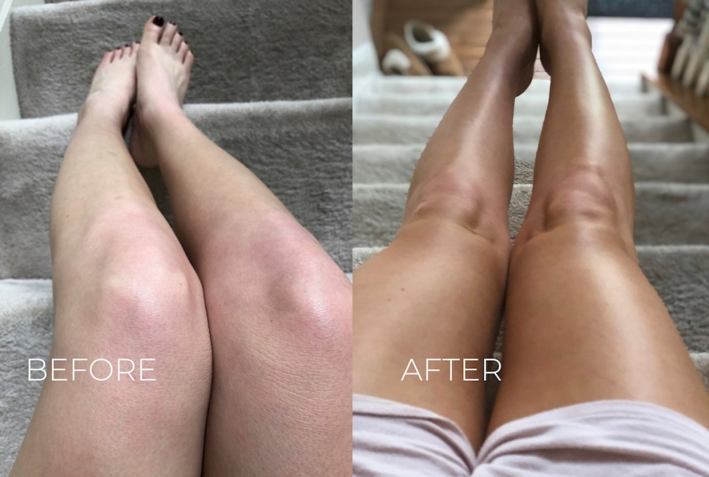 before and after of pale vs tan legs