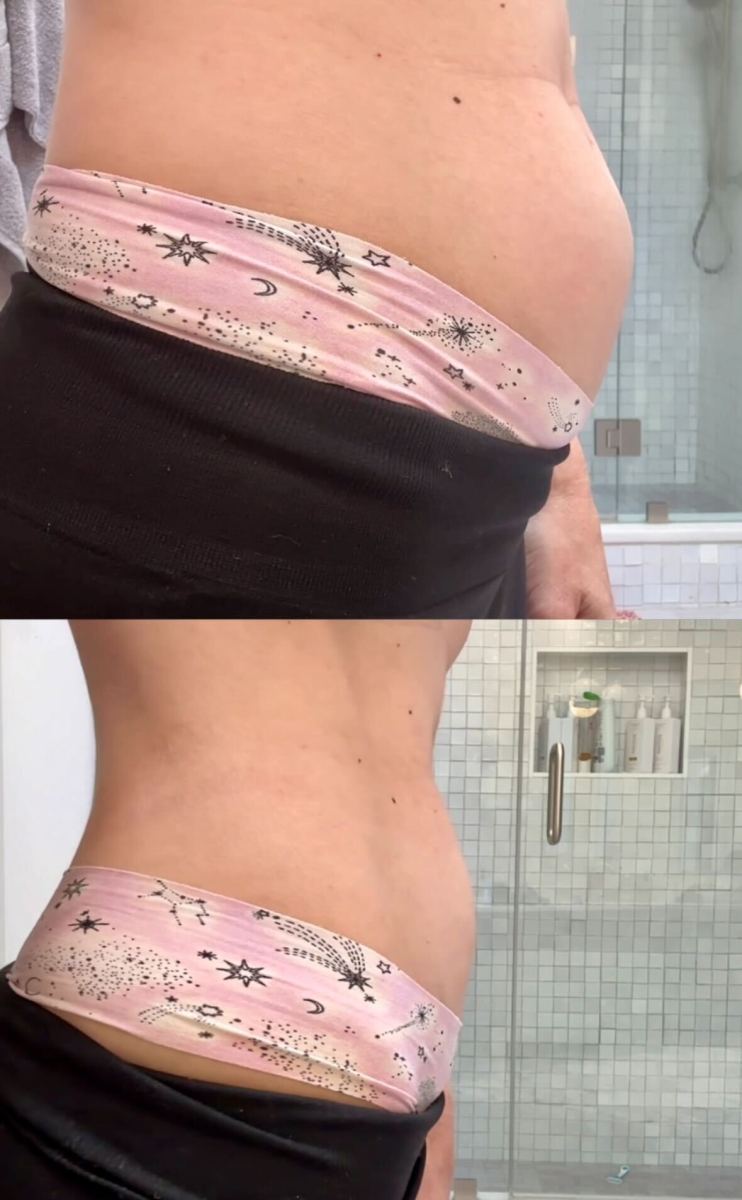 onlineparison of a womans stomach before and after taking jshealth bloat vitamins