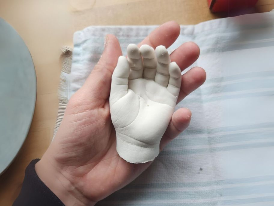 hand holding casted baby hand